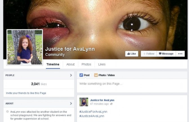 Facebook page serves justice for AvaLynn, a Mississippi child allegedly beaten by another student.
